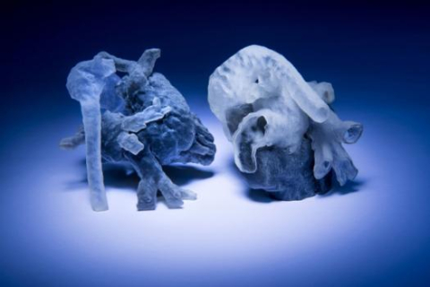 Printed in a matter of hours, personalized heart models could help surgeons plan their operations